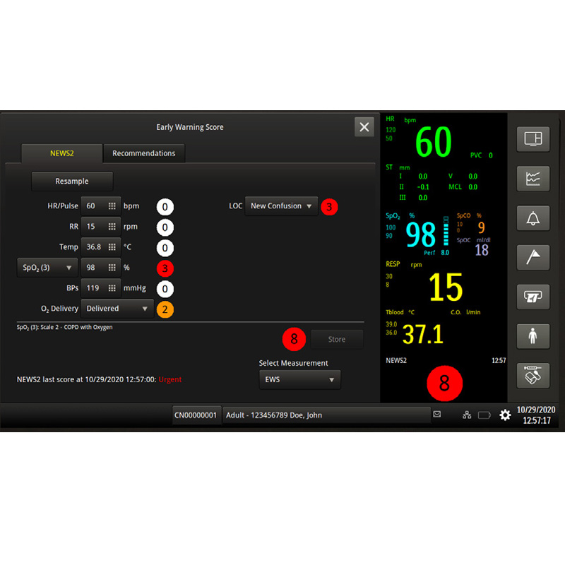Монитор пациента Philips Efficia CM12